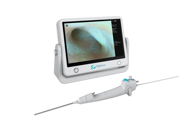 electronic endoscopy for sale