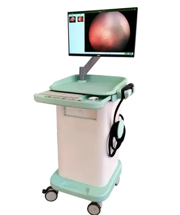 ultra wide angle fundus camera ultra wide angle fundus camera